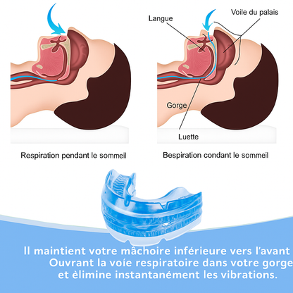 illustration du fonctionement du dispositif anti ronflement